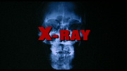 xray00.png