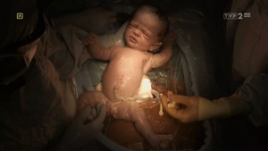 Baby.Surgeons.2020.S01.E01.PL.1080i.HDTV.H264-OzW.ts_snapshot_37.51.491.jpg